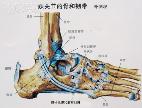 多是因为踢球时脚踝保护不到位,多次扭伤导致的踝关节骨质增生