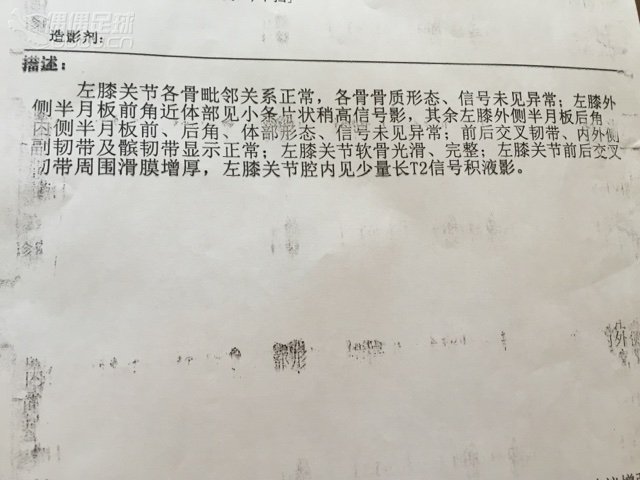 半月板损伤,各位大师麻烦看一下核磁共振的照片.