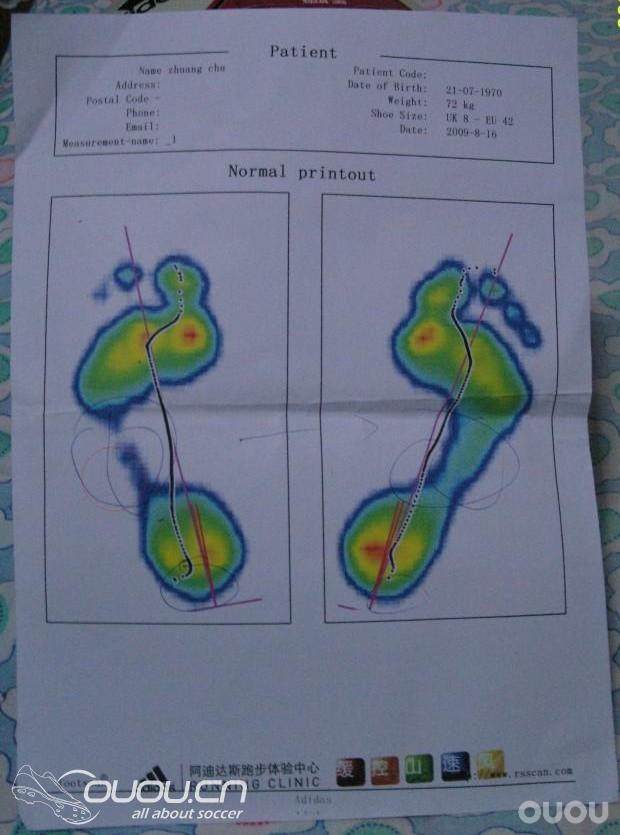 【新人必看】脚型测量图解——购鞋须知!