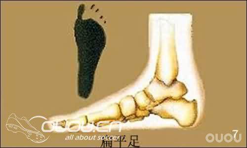 【新人必看】脚型测量图解——购鞋须知!