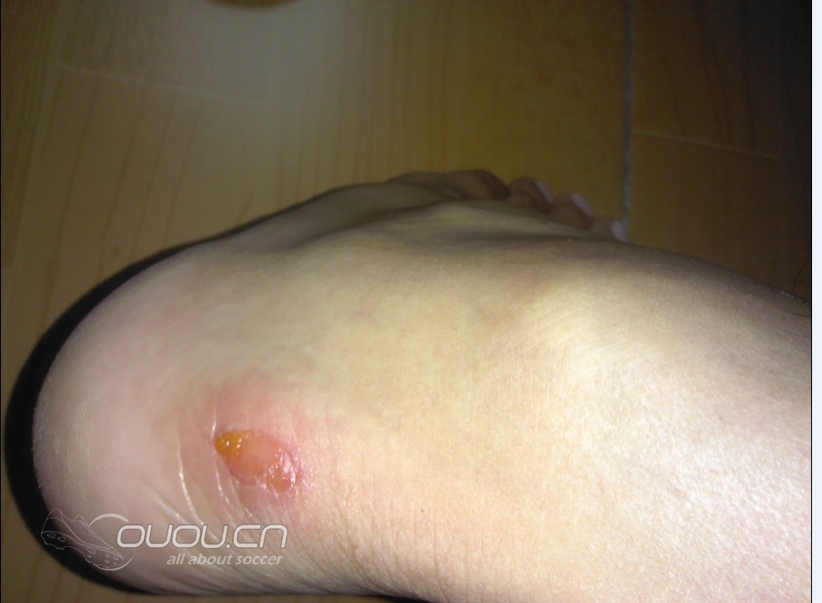 新买CTR 360 AG 白蓝  实战。