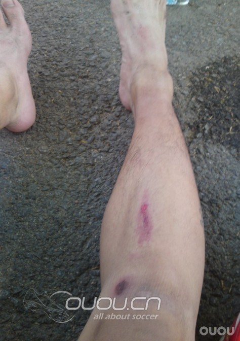 新入 猎8 小贝款