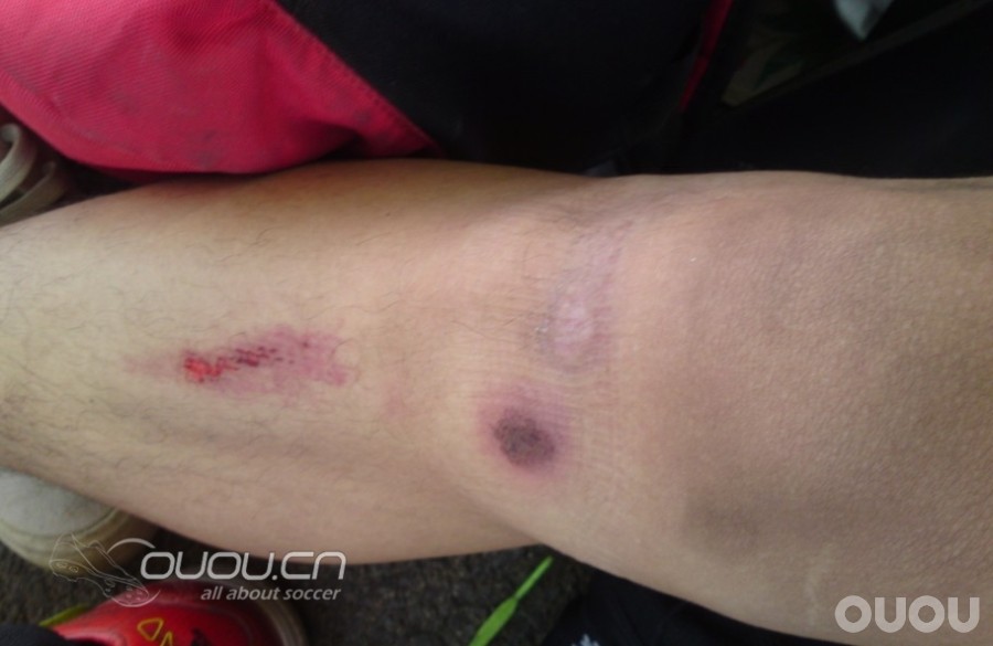 新入 猎8 小贝款