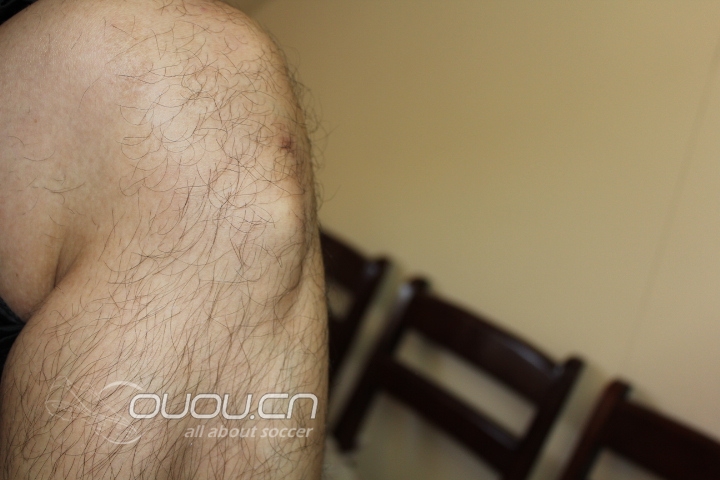 大家看看我这个骨头是不是有问题啊