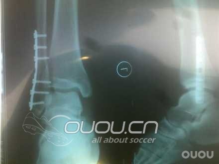 日落红 legend 4 fg