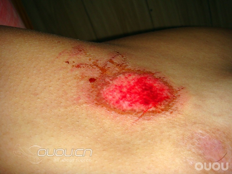 踢球被人阴了 真怒了 有图有真像