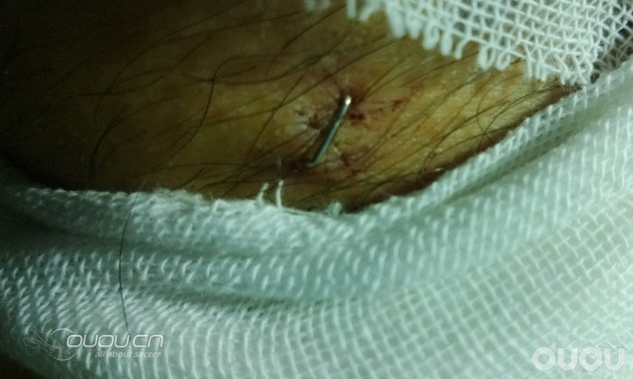 夏日炎炎,带来急速分享,浅谈SF3 MV8 MV9(内附刺激图片,慎入!)