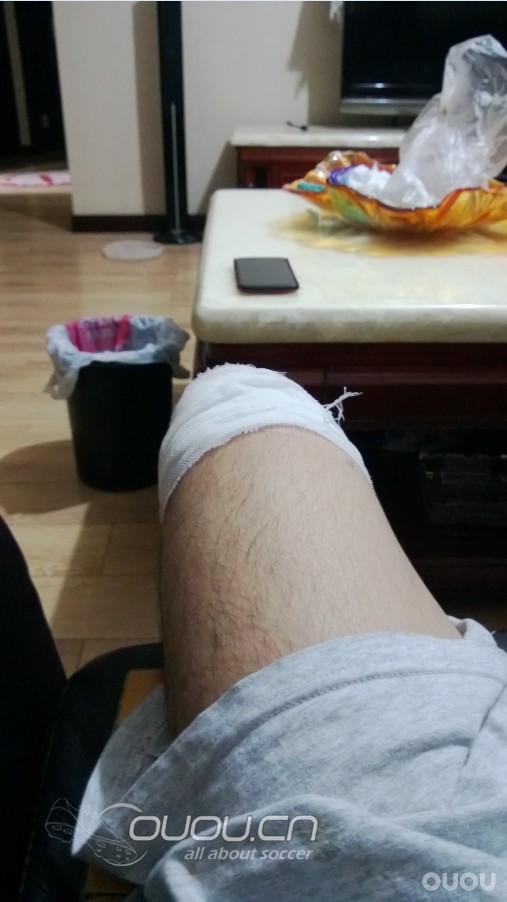 夏日炎炎,带来急速分享,浅谈SF3 MV8 MV9(内附刺激图片,慎入!)