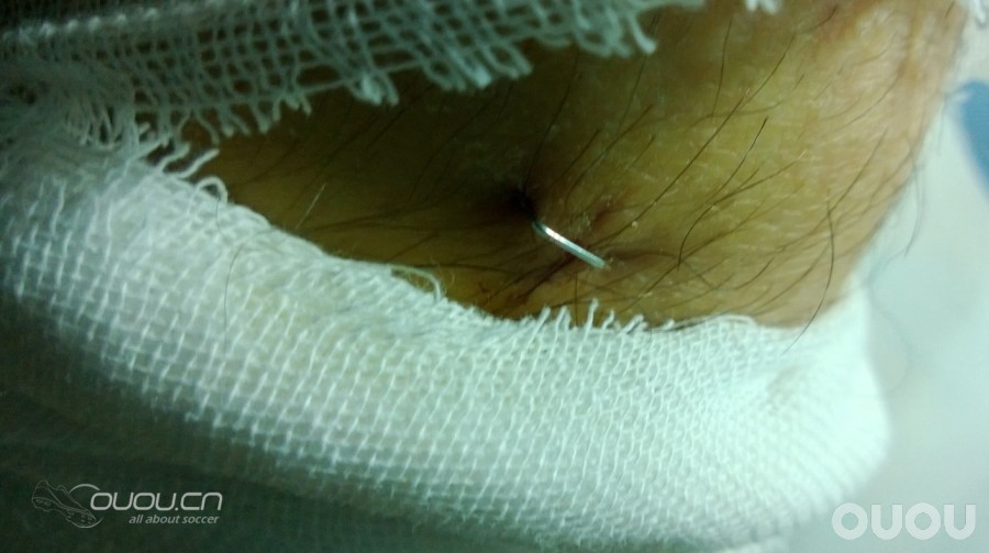 夏日炎炎,带来急速分享,浅谈SF3 MV8 MV9(内附刺激图片,慎入!)