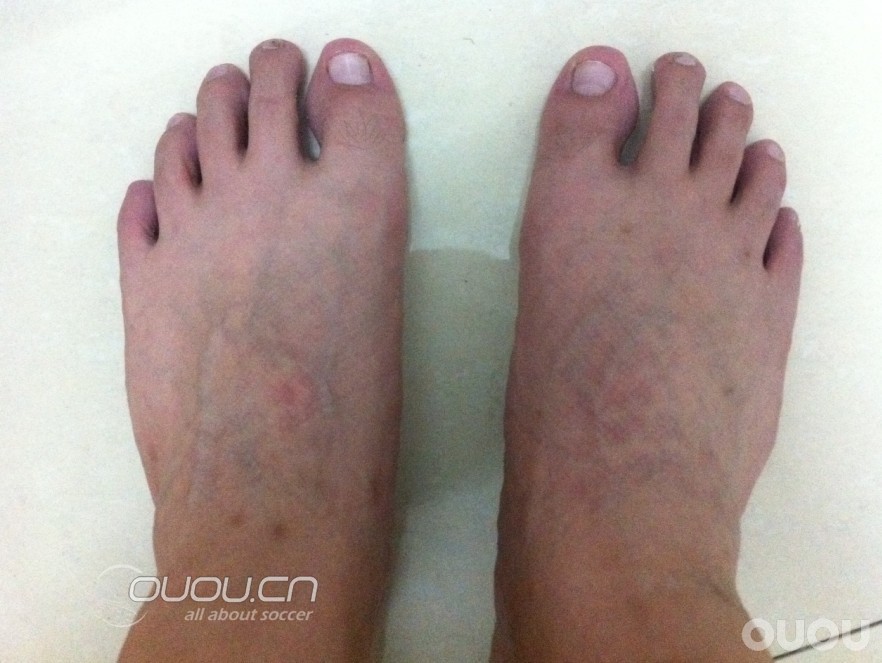 毒锋顶级AG & FG,妈妈再也不用担心我下什么地了(顺道展示毒锋适不适合宽脚)