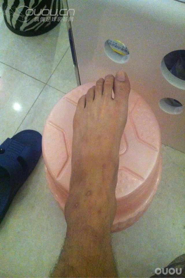 求助友友们,我的脚是不是只适合穿刺客。