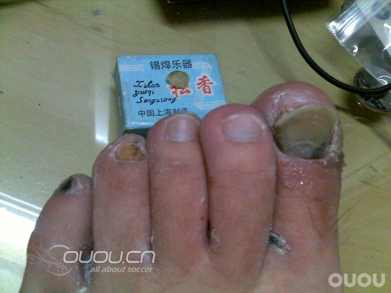 收了那么多,小窄脚觉得NIKE的鞋好挤脚。重口味