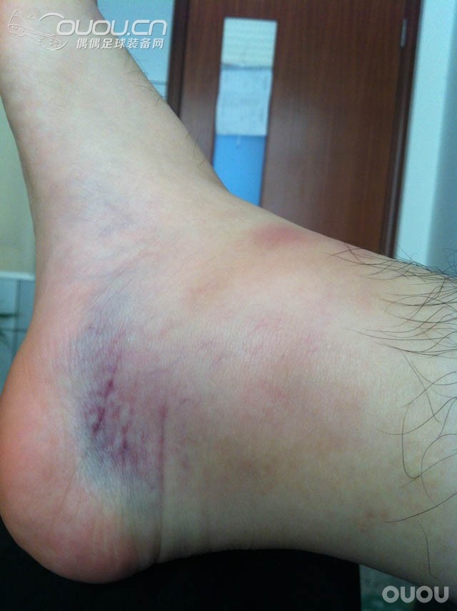 始战之殇–从399NEO到880 ES NEO