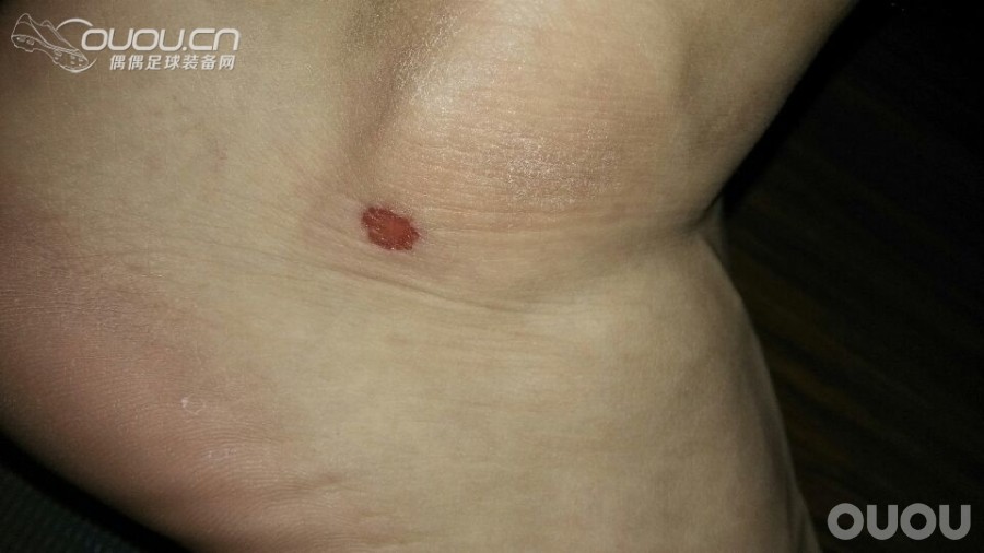 新入猎11次顶级hg,小场踢了一会左右脚就都磨成图片里那样了,求助各位大神怎么破。