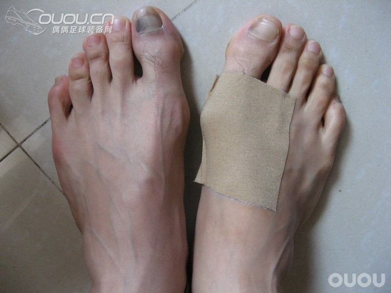 我就是我,黑,有什么不可以!多图慎入!