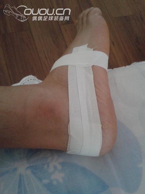 我是如何解决鞋子磨脚后跟问题的。