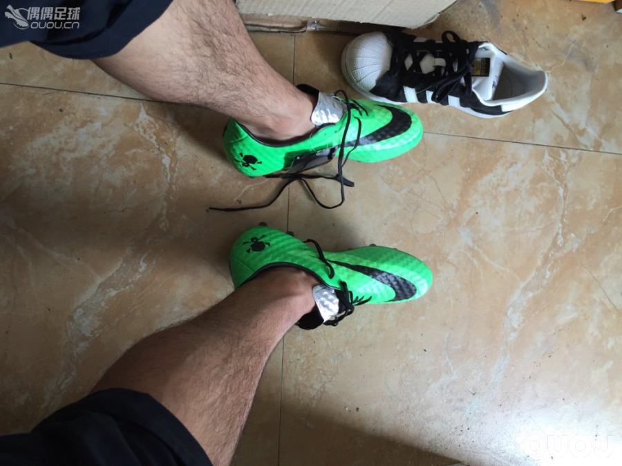 刚到的代购毒蜂顶级hg,求鉴定