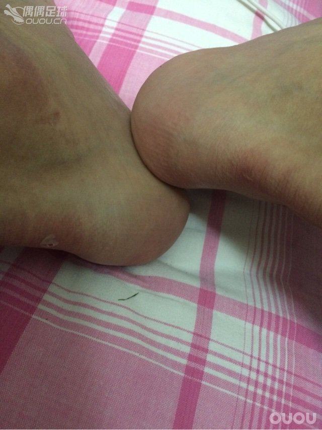 一脚变两脚~一天踢两场~心醉~泡也碎~