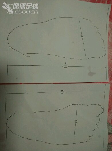 这样的脚是不是就告别毒蜂了?