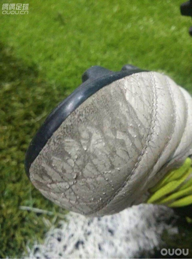 新人小白求问,这种情况正常吗?今天6月购于朋友的实体店,本人脚型自认很正,踢球频率在每月两场到三场