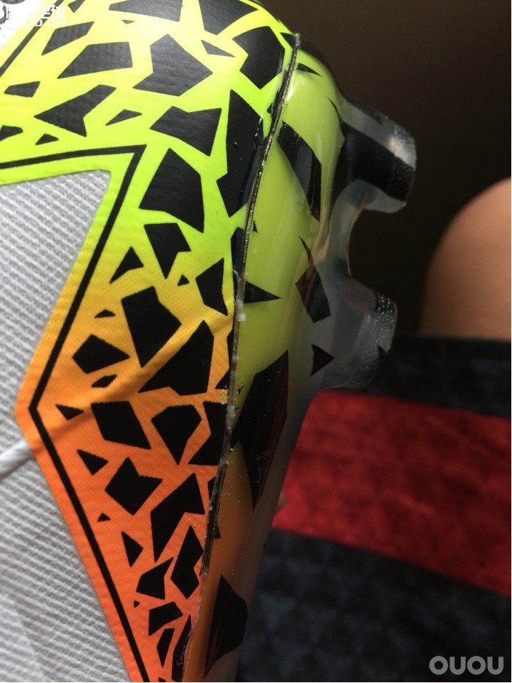 这个属于正常现象吗?