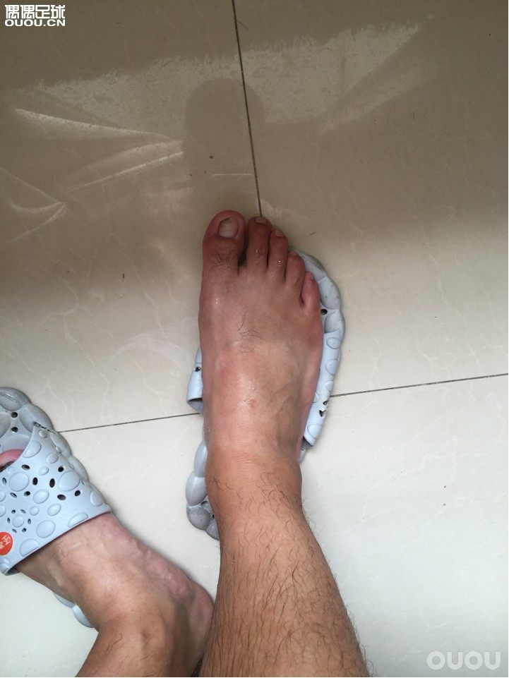 问一下各位大神,小弟这算不算屠龙脚???想入手一双evo,不知合不合适!!!