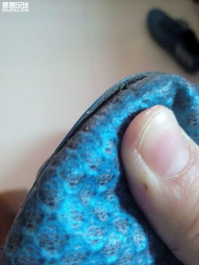 大神们,球鞋比以前更严重了,这个粘粘能好了吗