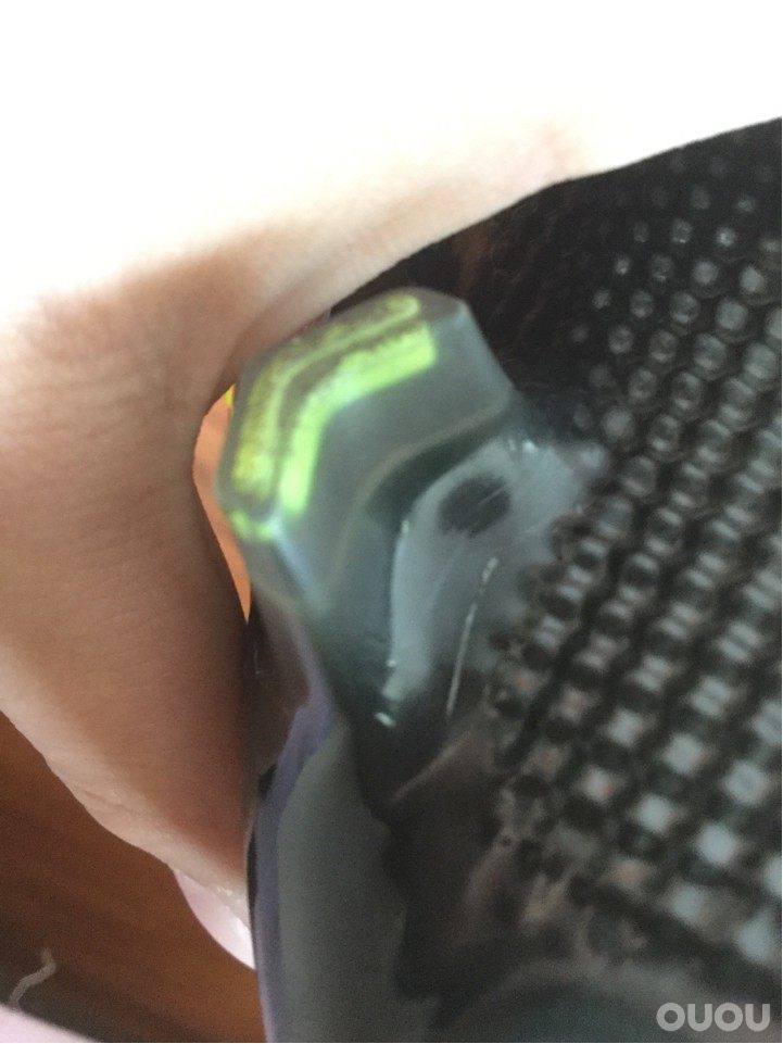 下地一场后左脚后钉就这样了,会断吗?