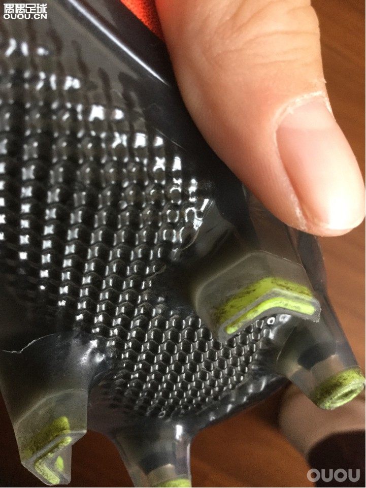 下地一场后左脚后钉就这样了,会断吗?