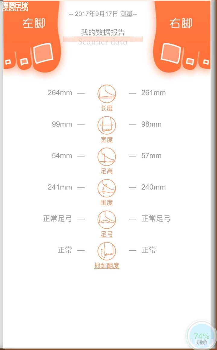 我这个属于什么脚?