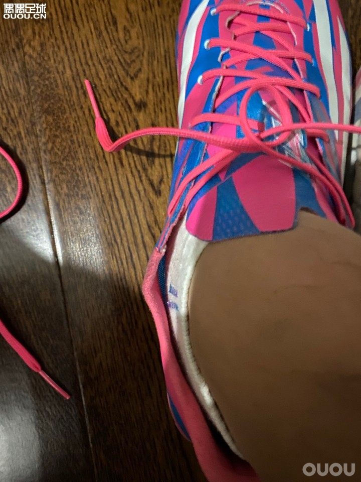 请教一下各位,鞋子有点长,系紧鞋带后这里总是向外鼓,有什么好的方法解决吗?感谢?