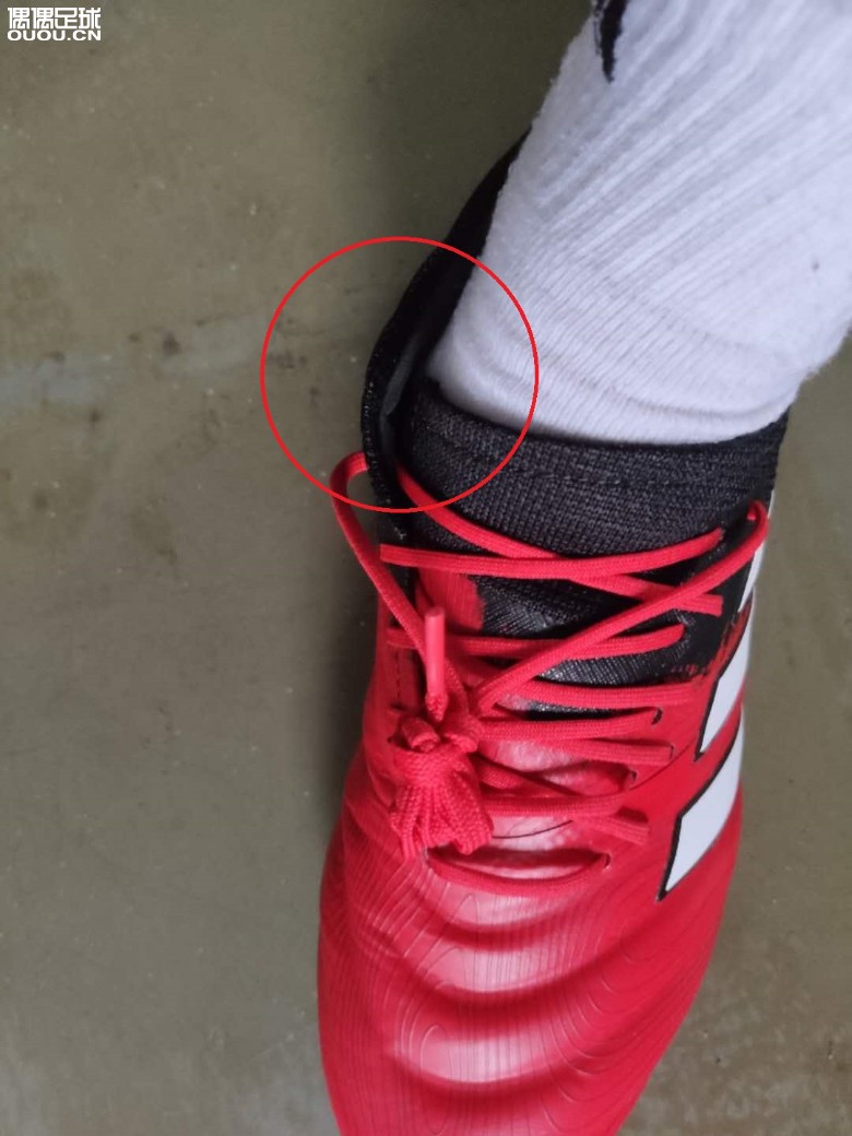 COPA20.1 鞋口这种情况正常吗?