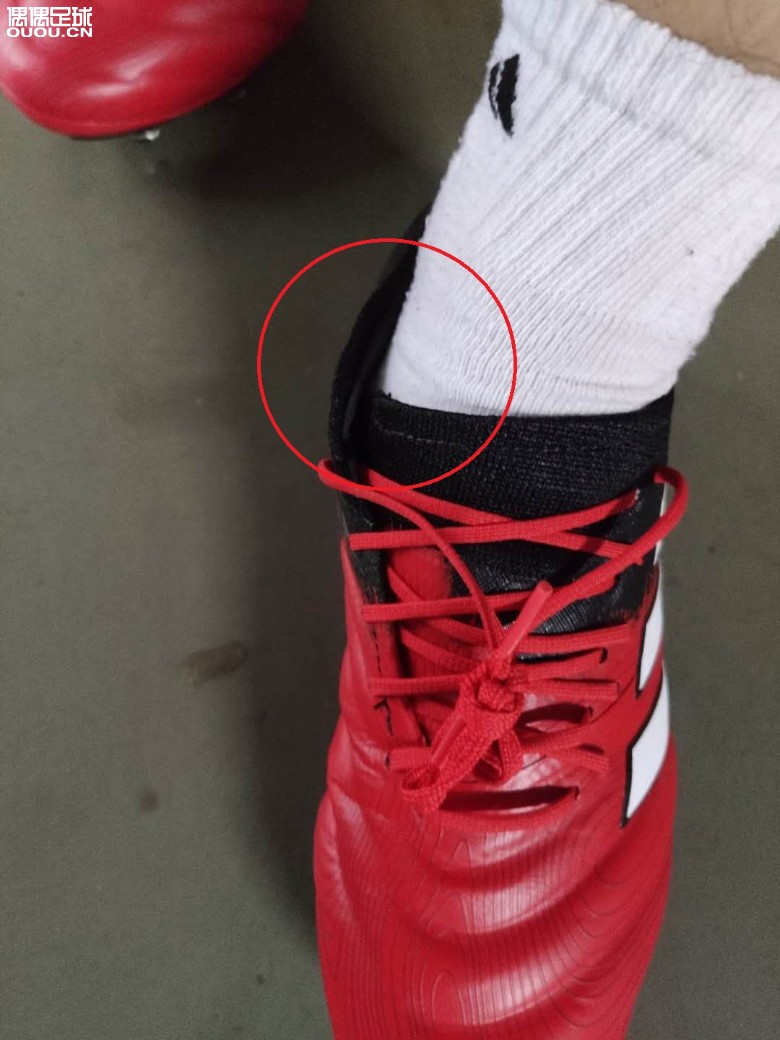 COPA20.1 鞋口这种情况正常吗?