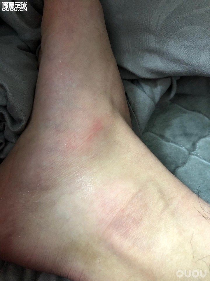 今天踢得是五人制,之前静态和玩玩的时候感觉整双鞋很紧,所以今天穿了薄袜